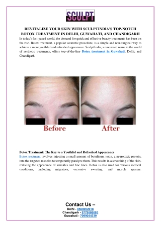 REVITALIZE YOUR SKIN WITH SCULPTINDIA'S TOP-NOTCH BOTOX TREATMENT