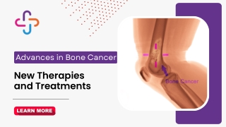 Advances in Bone Cancer | New Therapies and Treatments