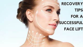 RECOVERY  TIPS  FOR A  SUCCESSFUL  FACELIFT