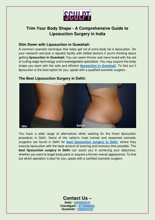 Trim Your Body Shape - A Comprehensive Guide to Liposuction Surgery in India