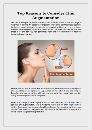 Top Reasons to Consider Chin Augmentation