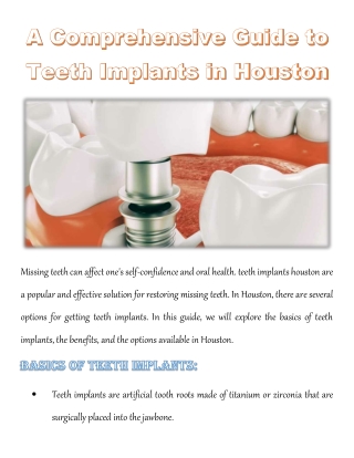 A Comprehensive Guide to Teeth Implants in Houston