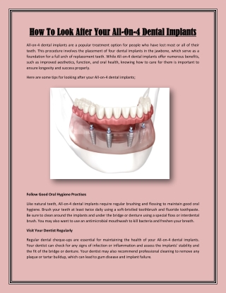 How To Look After Your All-On-4 Dental Implants