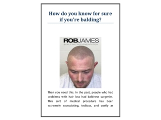 How do you know for sure if you're balding