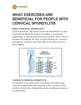 Cervical Spondylitis treatment