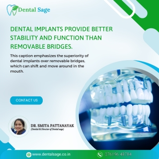 Dental implants provide better stability and function - Dental Sage