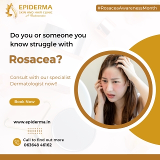 Struggling with Rosacea - Best Skin Clinic in Jayanagar - Epiderma Clinic