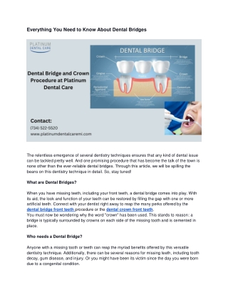 Everything You Need to Know About Dental Bridges