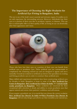 The Importance of Choosing the Right Ocularist for Artificial Eye Fitting in Bangalore India