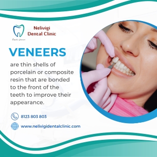 Veneers | Best Dental Clinic in Bellandur, Bangalore | Nelivigi Dental Clinic