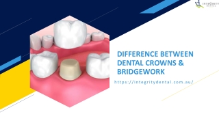 DIFFERENCE BETWEEN DENTAL CROWNS & BRIDGEWORK