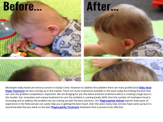 Plagiocephaly Helmet & Baby Skull Deformation Treatment UK