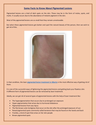 Some Facts to Know About Pigmented Lesions | Pigmented Lesions Treatment