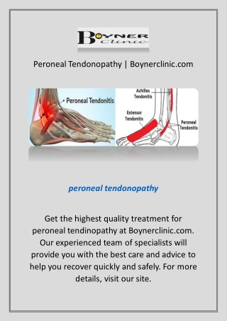 Peroneal Tendonopathy | Boynerclinic.com