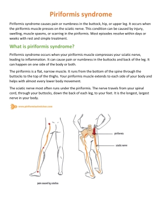 Piriformis Syndrome vs Sciatica  Cause  Symptoms  How to Self Release (PDF)