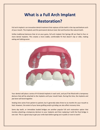 What is a Full Arch Implant Restoration?