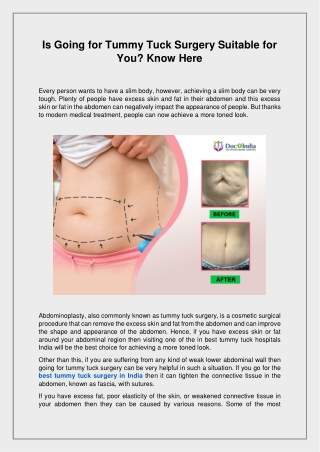 Is Going for Tummy Tuck Surgery Suitable for You