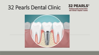 Best Dental Implant in India