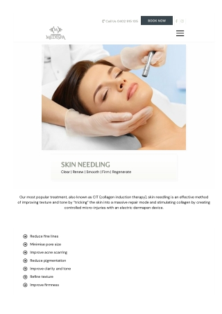 Transform Your Skin with Micro-Needling Treatments in Morningside