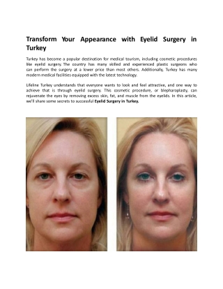 Transform Your Appearance with Eyelid Surgery in Turkey