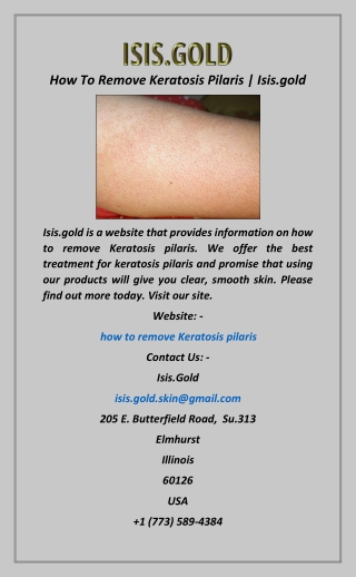 How To Remove Keratosis Pilaris  Isis.gold