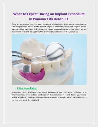 What to Expect During an Implant Procedure in Panama City Beach, FL