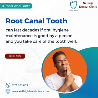 Root Canal Tooth | Best Dental Clinic in Bellandur, Bangalore | Nelivigi Dental
