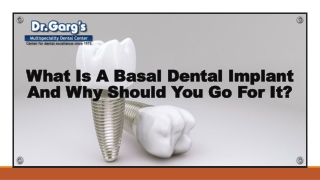 What Is A Basal Dental Implant And Why Should You Go For It?