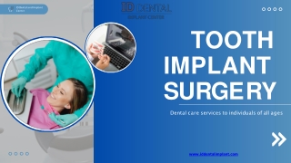 Tooth Implant Surgery -  ID Dental and Implants Center