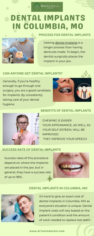 DENTAL IMPLANTS IN COLUMBIA, MO