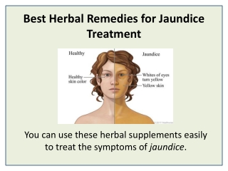 Cure and prevention of jaundice with Jaundinil Capsule