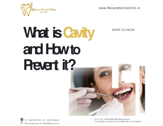 Dental Cavity Protection Treatment in Tricity-Life Care Dental Clinic