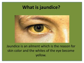Herbal Remedies to Fight the Jaundice Disorder