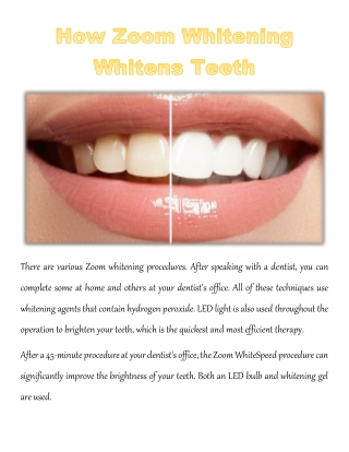 How Zoom Whitening Whitens Teeth