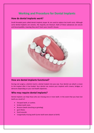 Working and Procedure for Dental Implants