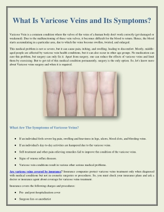 What Is Varicose Veins and Its Symptoms?