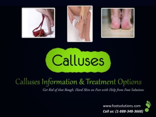 Calluses Information and Treatment