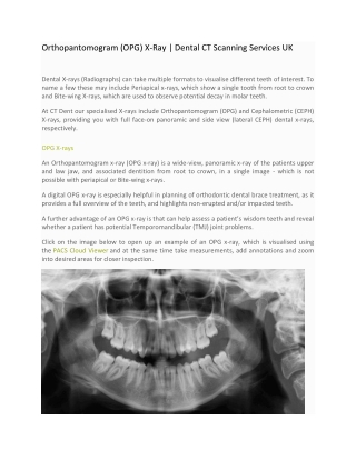 Orthopantomogram (OPG) X-Ray, Dental CT Scanning Services UK - CT Dent Ltd