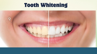 Tooth Whitening