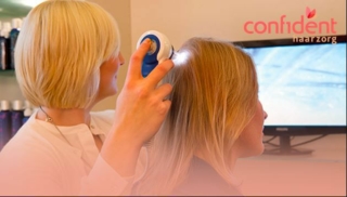 Haaruitval vrouwen wat je moet weten en hoe je het kunt aanpakken