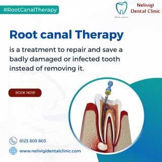 Get treated an infected tooth with Root canal treatment | Nelivigi Dental Clinic