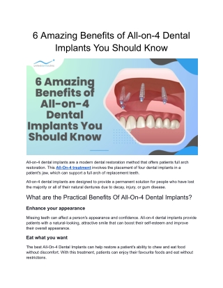 6 Amazing Benefits of All-on-4 Dental Implants You Should Know