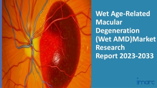 Wet Age-Related Macular Degeneration (Wet AMD) Market 2023: Epidemiology, Trends