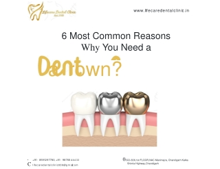 6 Most Common Reasons Why You Need a Dental Crown-Life Care Dental Clinic Chandigarh