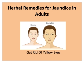 Jaundinil Helps in the Treatment of Jaundice