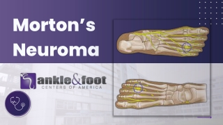 What is a Morton's Neuroma