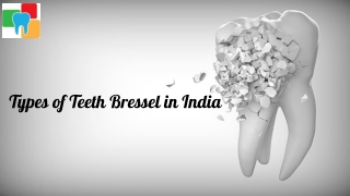 Types of Teeth Bressel in India