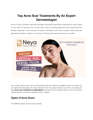 Top Acne Scar Treatments By An Expert Dermatologist