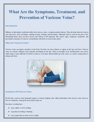 What Are the Symptoms, Treatment, and Prevention of Varicose Veins?