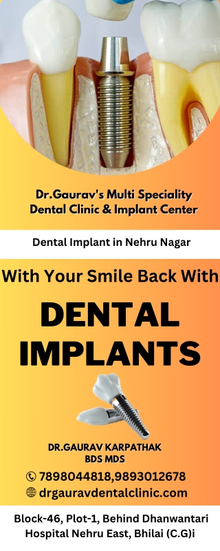 dental implant in nehru nagar